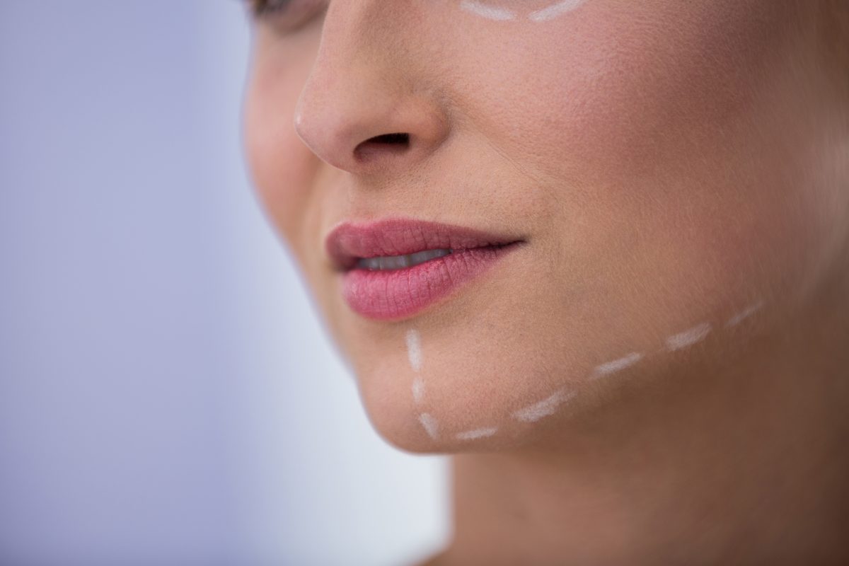 woman-with-marks-drawn-cosmetic-treatment-her-jaw-1200x800.jpg