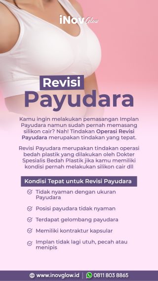 Revisi Payudara di Jakarta