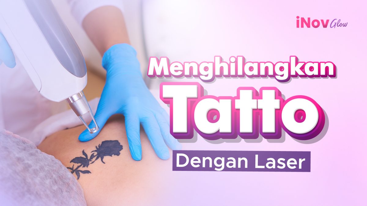 9-November_menghilangkan-tatto-1200x675.jpg