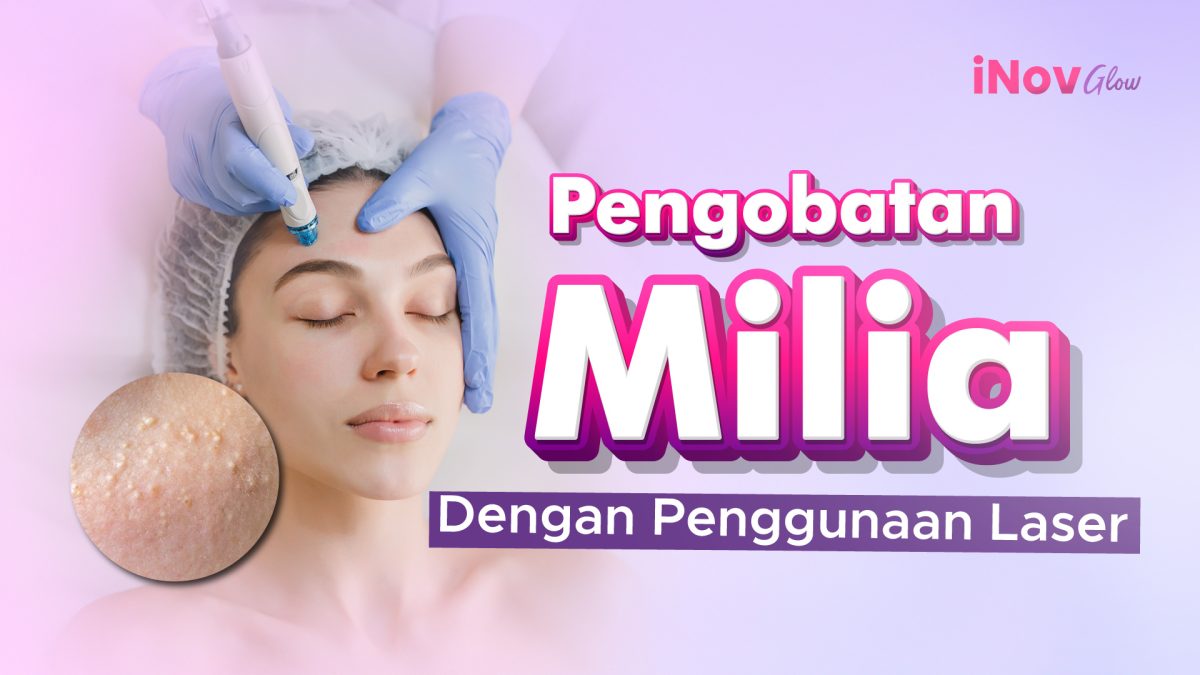 9-November_pengobatan-milia-1200x675.jpg