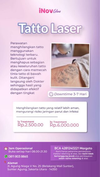 Penghilangan Tato dengan Laser