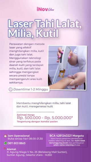 Manfaat Laser Tahi Lalat untuk Kecantikan