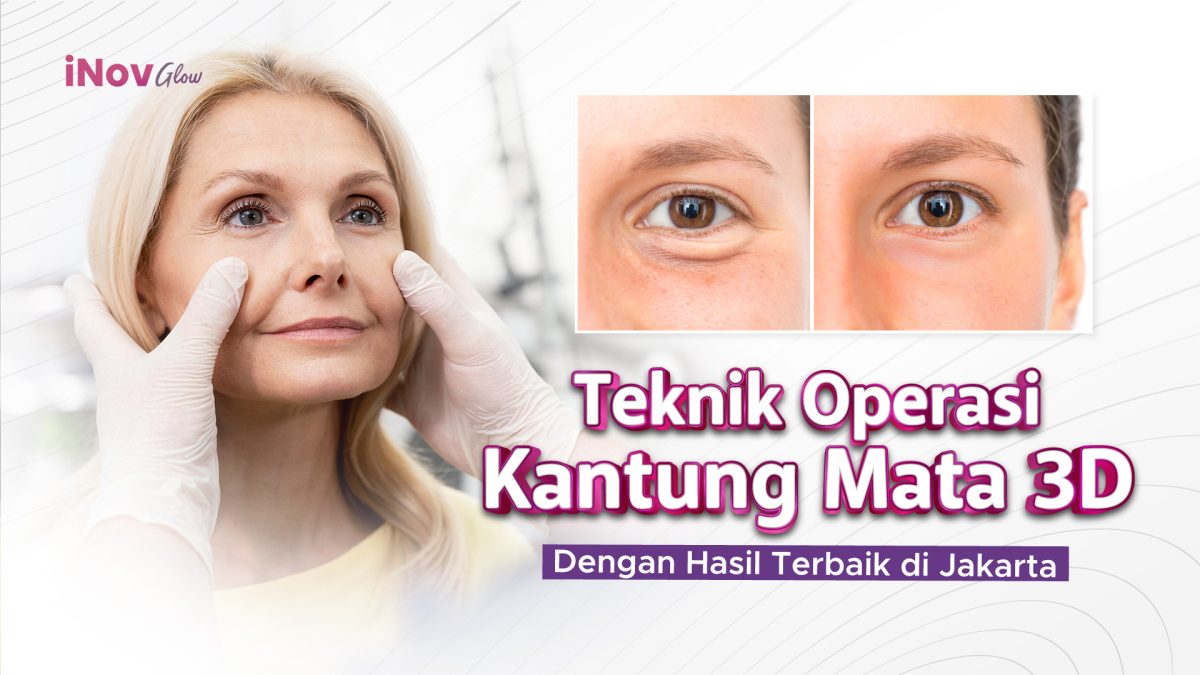 17-November_Teknik-Operasi-Kantung-Mata-1200x675.jpg