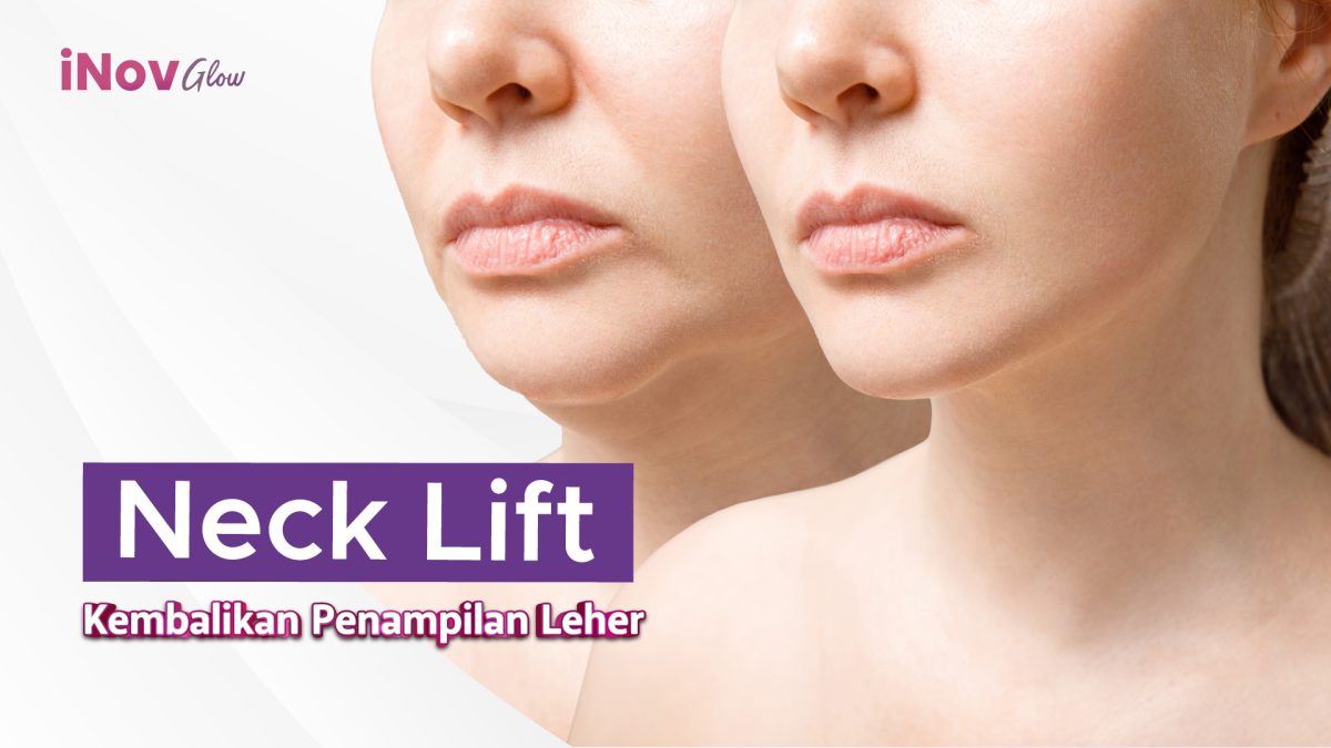 28-November_NECK-LIFT-KEMBALIKAN-PENAMPILAN-LEHER-1200x675.jpg