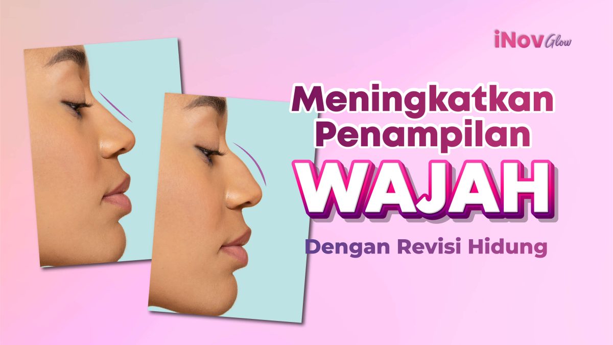 20-Maret-03-2-1200x675.jpg