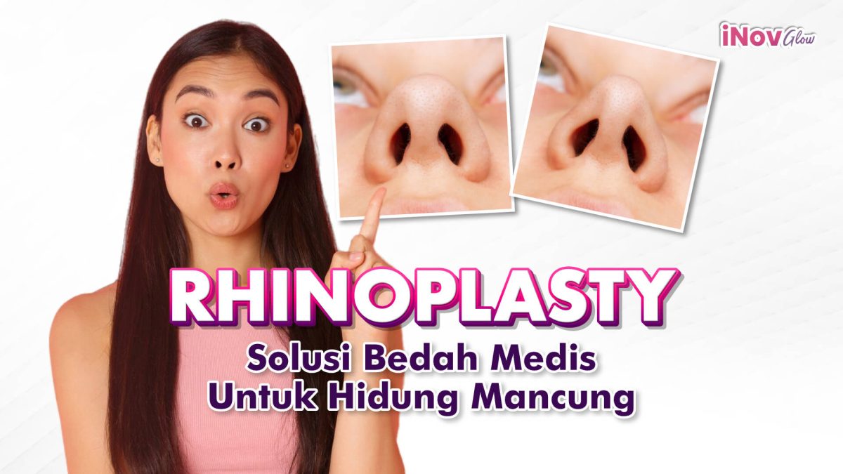 Rhinoplasty-Solusi-Bedah-Medis-untuk-Menciptakan-Hidung-Mancung-di-Klinik-Inov-Glow-1200x675.jpg