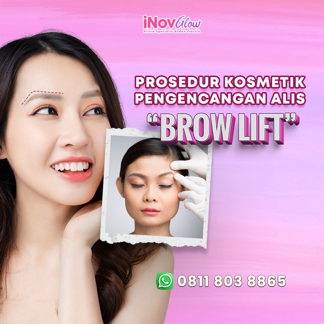 Prosedur-Kosmetik-Pengencangan-Alis-Brow-Lift-fotor-20240528143957.jpg