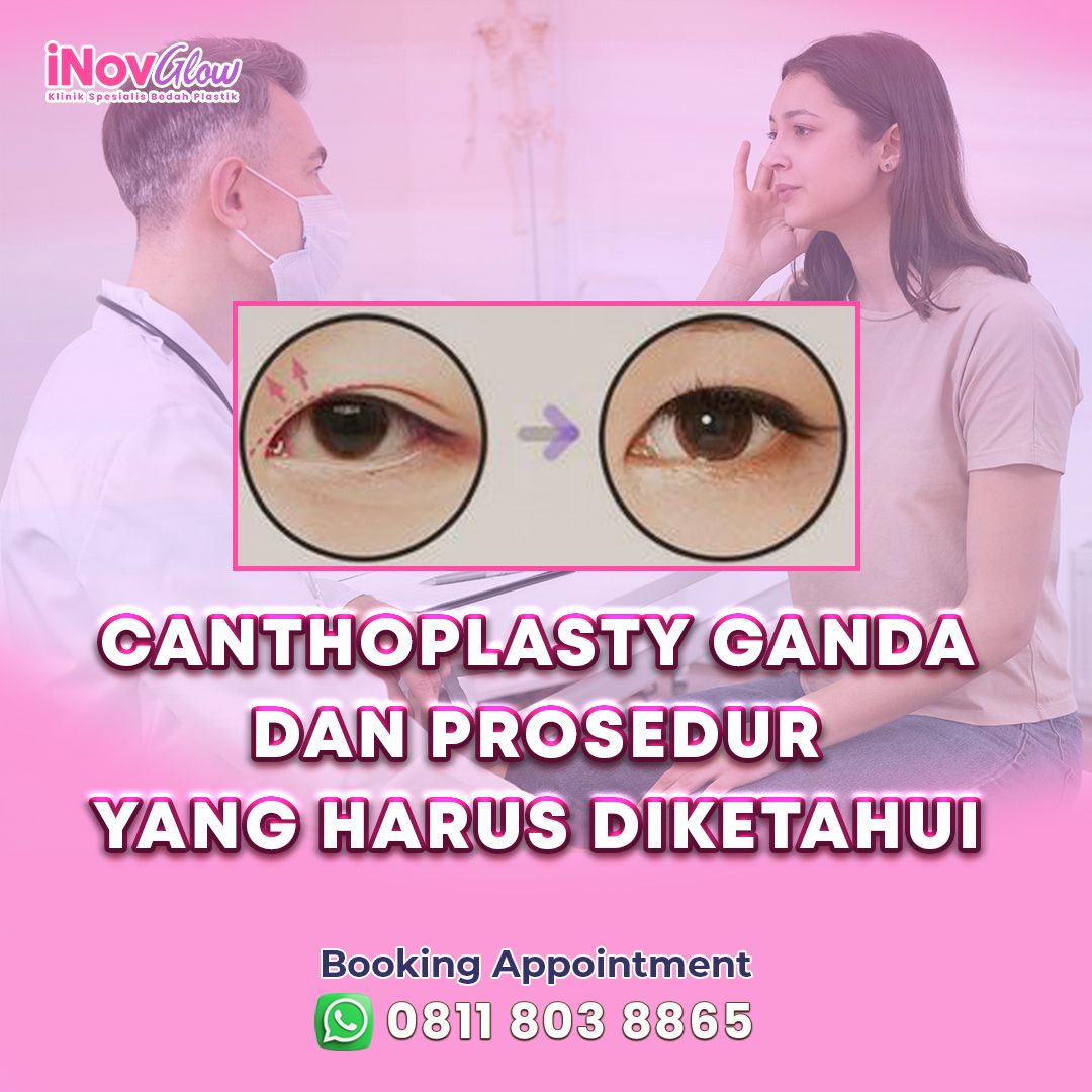 Canthoplasty-Ganda-dan-Prosedur-yg-harus-di-Ketahui-inov-.jpg