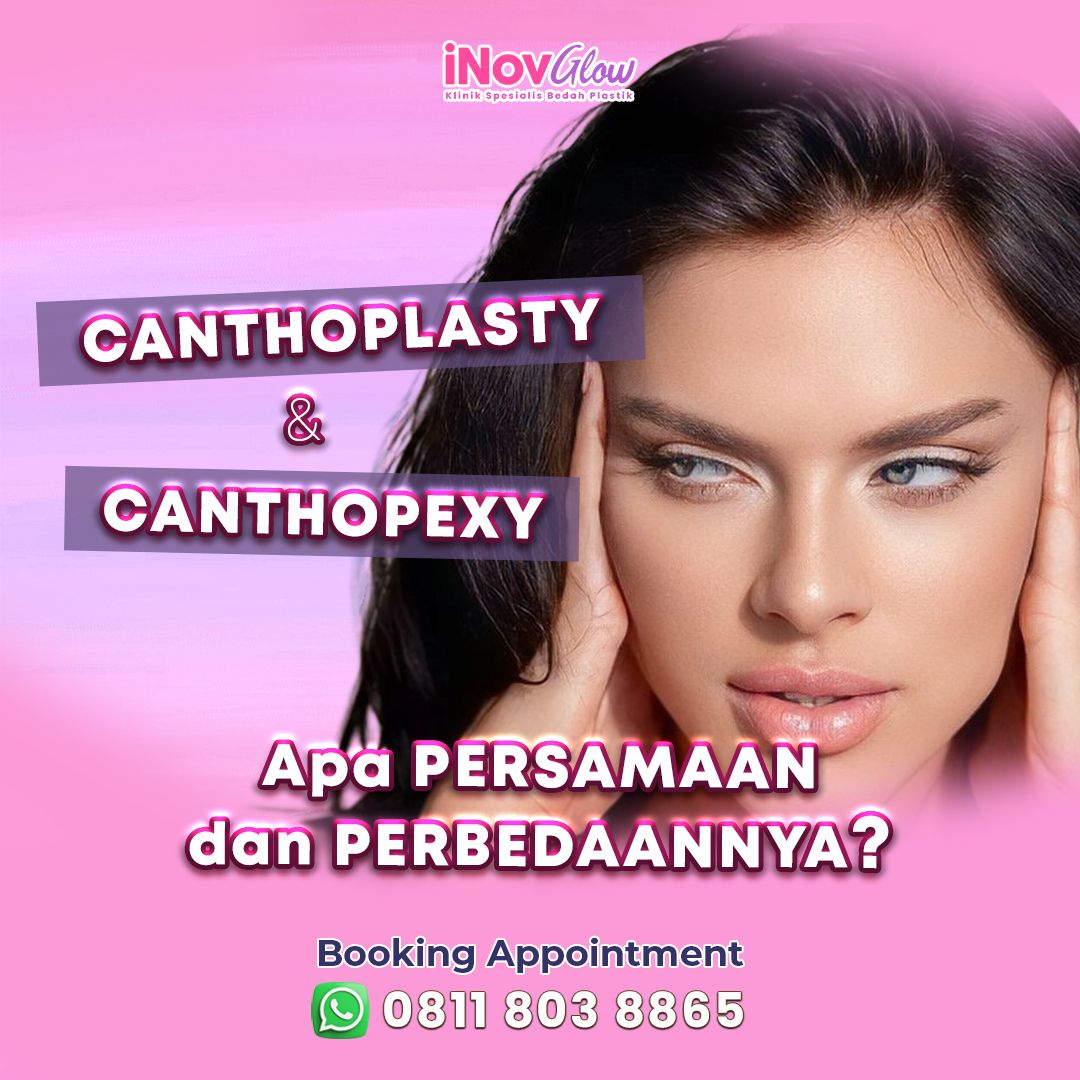 Canthoplasty-n-Canthopexy-Persamaan-dan-Perbedaannya-inov-1-.jpg