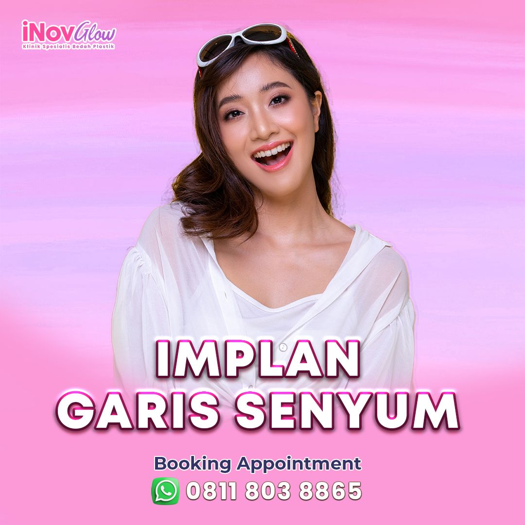 Implan-Garis-Senyum-inov-.jpg