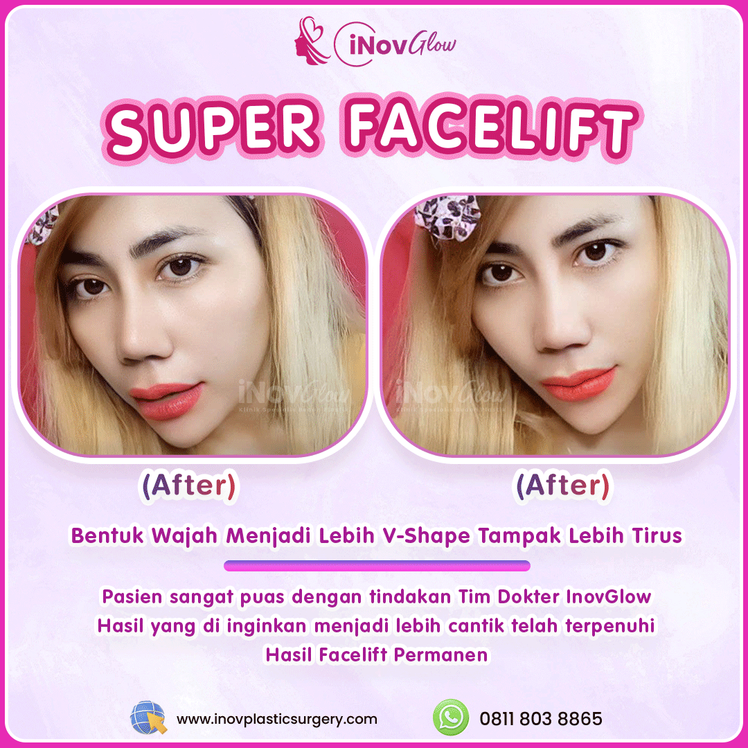 Super-Facelift-InovGlow-Feed-001.png